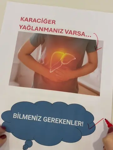 Karaciğer yağlanması: bilmeniz gerekenler